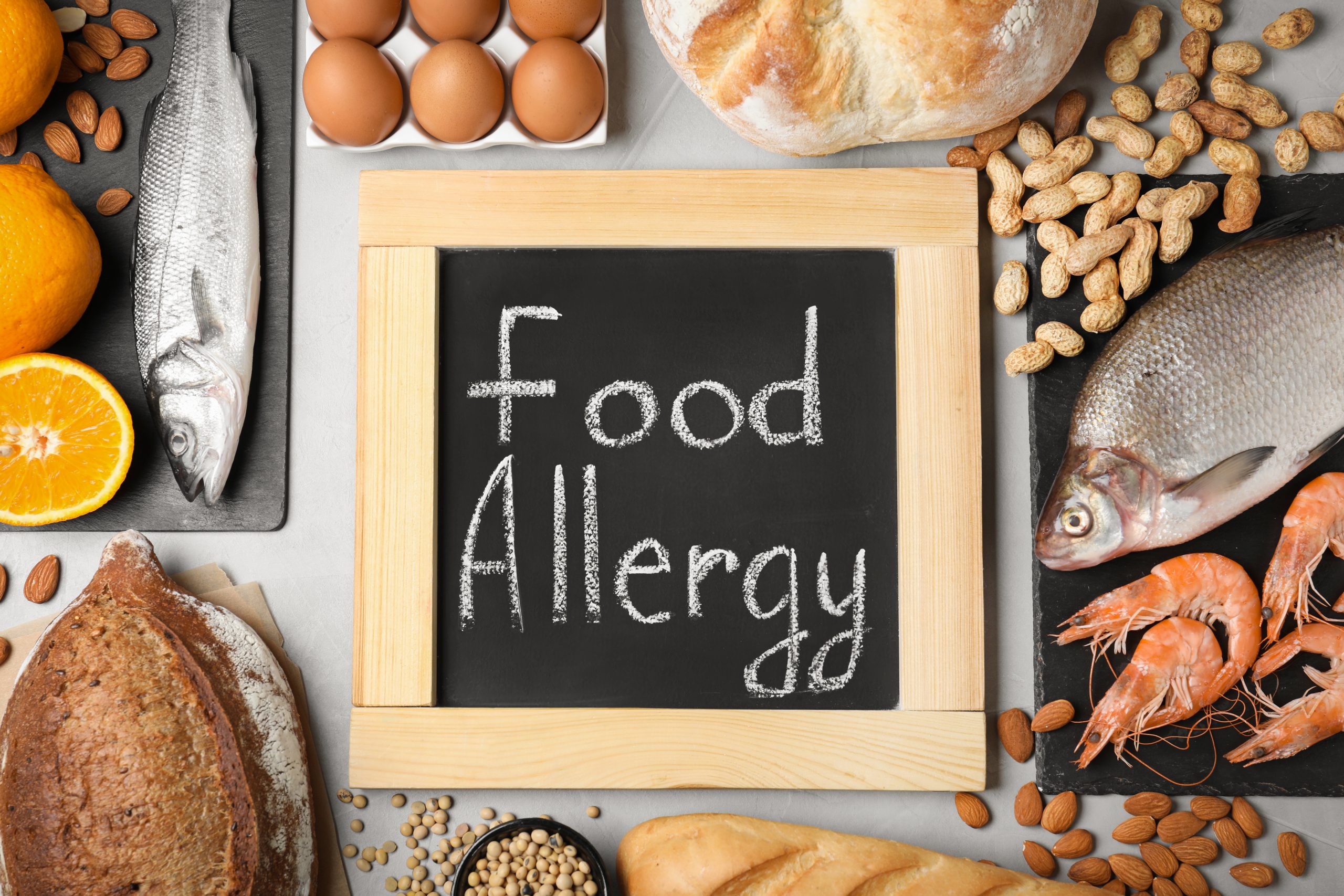 Food Allergens Awareness